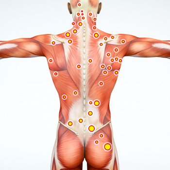 Trigger Point Therapy - Treating Pectoralis Major, Pectoralis Muscles,  Shoulder and more