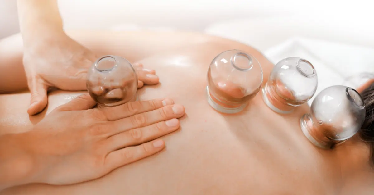 Glass cups placed along a client's back during a cupping session