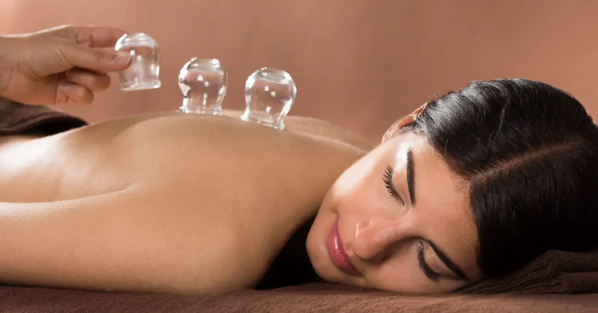 Woman relaxing face-down as a therapist sets glass cupping cups on her upper back